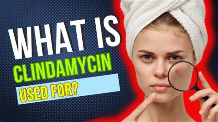 Is clindamycin a fluoroquinolones