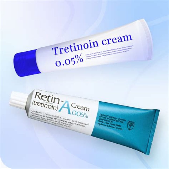 Is isotretinoin a permanent cure for acne