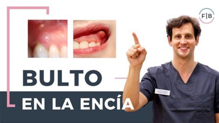 ¿Qué puede ser un bulto en el estómago