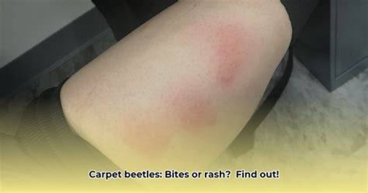 What do carpet beetle bites look like