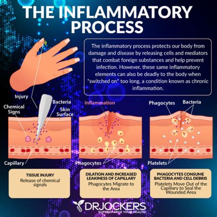 What is an inflammation of the vein that can cause blood clots called quizlet