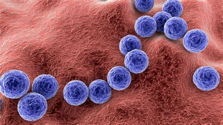 What is the skin test used to diagnose S pyogenes infection
