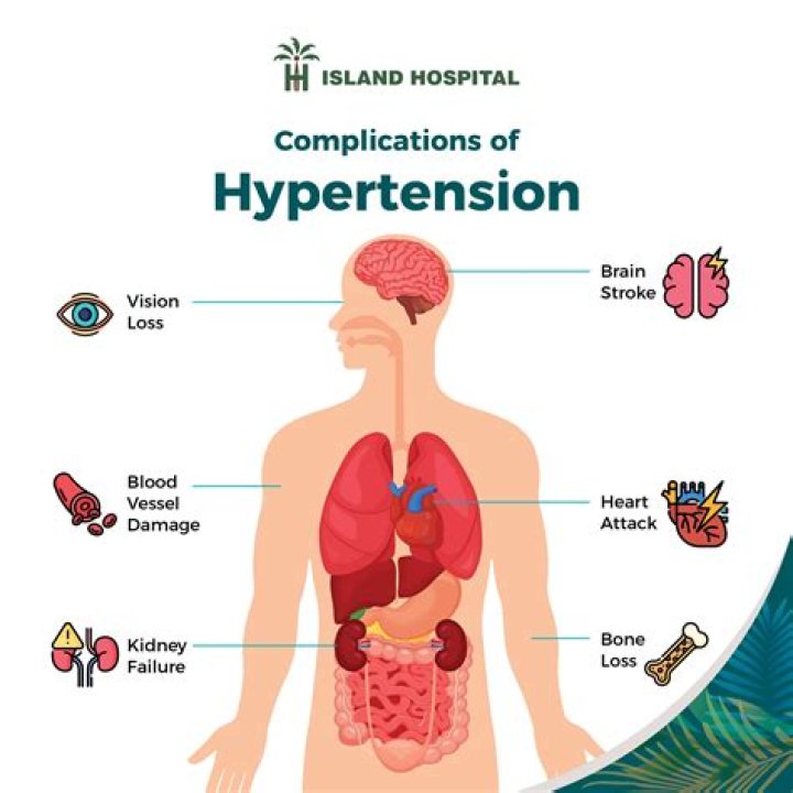 Which is a complication of hypertension in the brain